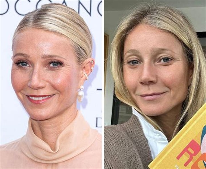bare-faced celebrities