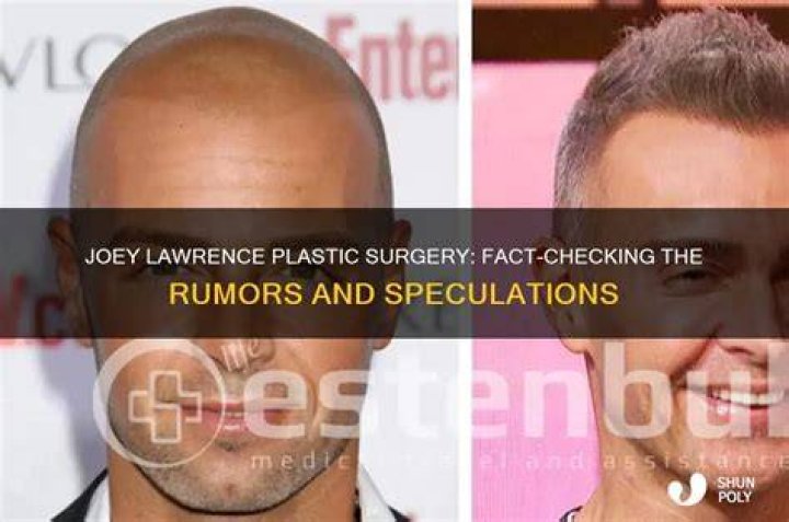 Joey Lawrence Plastic Surgery | Did He Get A Botox