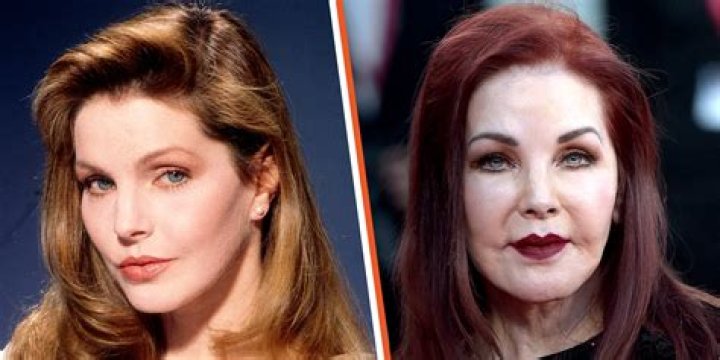 Priscilla Presley face lift surgery
